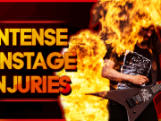 10 Intense Onstage Injuries Onstage Injuries